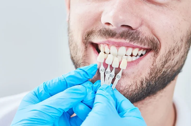 Cosmetic-Dentistry-0