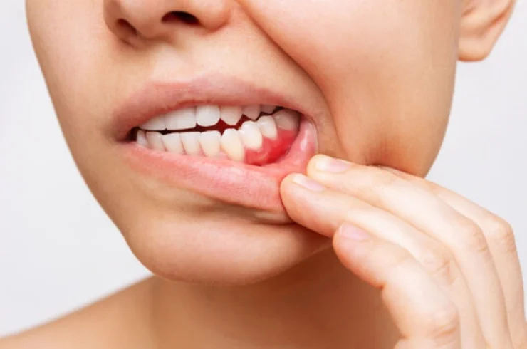 Periodontics (Gum Treatments)-------0